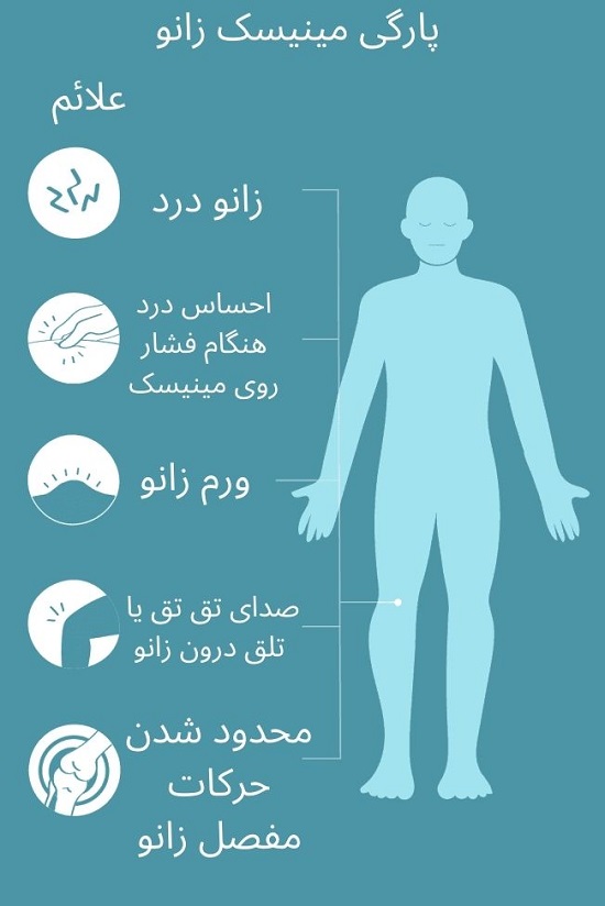 علائم پارگی مینیسک زانو